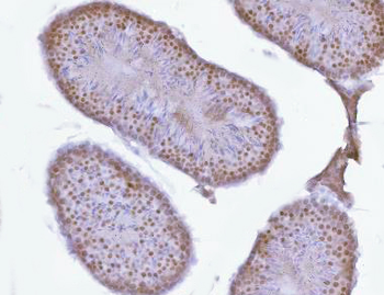 PRPF18 Antibody