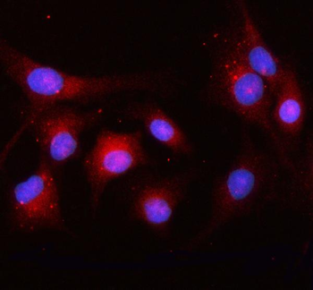 OSBPL10 Rabbit Polyclonal Antibody