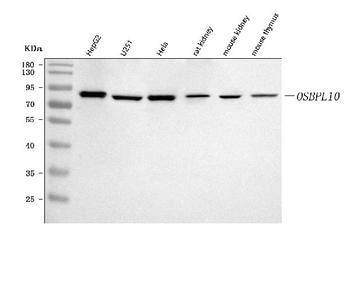 OSBPL10 Rabbit Polyclonal Antibody