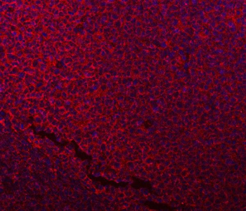NDUFB7 Rabbit Polyclonal Antibody