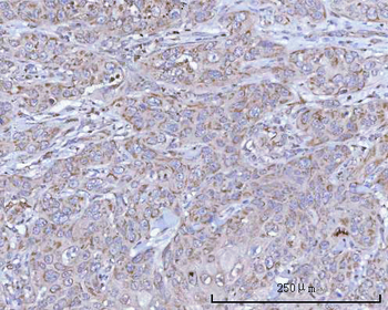 NDUFB7 Rabbit Polyclonal Antibody