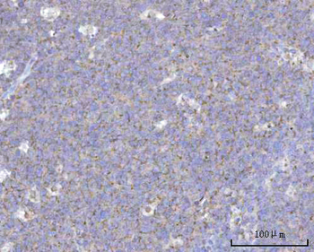 NDUFB7 Rabbit Polyclonal Antibody