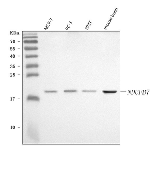 NDUFB7 Rabbit Polyclonal Antibody