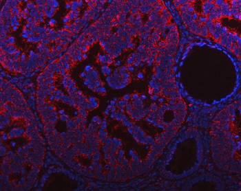 NDUFAF4 Antibody