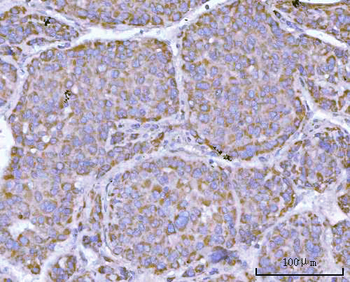 NDUFAF4 Antibody