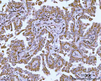 NDUFAF4 Antibody