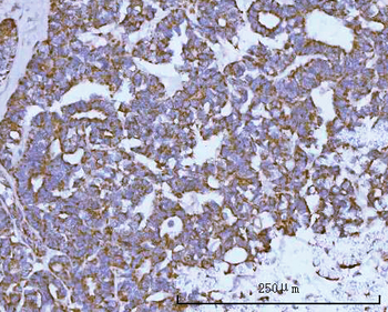 NDUFAF4 Antibody