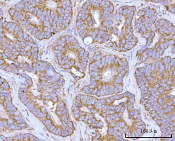 NDUFAF4 Antibody
