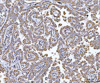 GRIM19/NDUFA13 Antibody