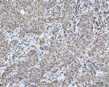 GRIM19/NDUFA13 Antibody