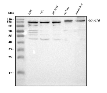 NARG1L/NAA16 Rabbit Polyclonal Antibody