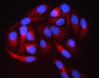 PIGS Rabbit Polyclonal Antibody
