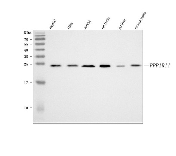 PPP1R11 Rabbit Polyclonal Antibody