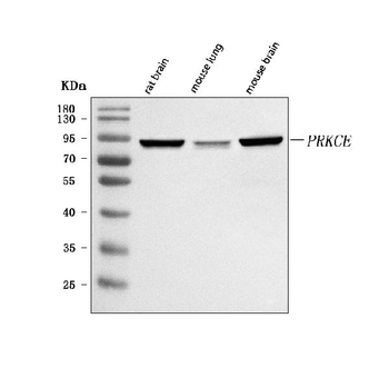 PRKCE Rabbit Polyclonal Antibody