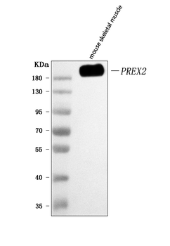 PREX2 Rabbit Polyclonal Antibody
