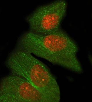 PRDM8 Antibody