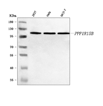 PPP1R15B Rabbit Polyclonal Antibody