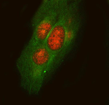LYPLA3/PLA2G15 Rabbit Polyclonal Antibody