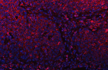 PLD6 Antibody
