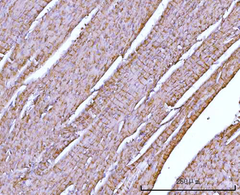 NDUFA7 Rabbit Polyclonal Antibody