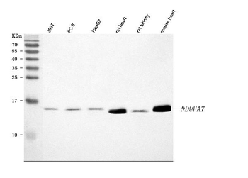 NDUFA7 Rabbit Polyclonal Antibody
