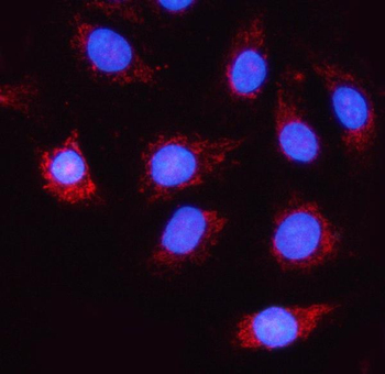 NDUFA5 Rabbit Polyclonal Antibody