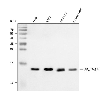 NDUFA5 Rabbit Polyclonal Antibody
