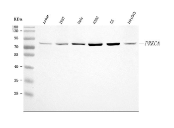 PKC Alpha/PRKCA Rabbit Polyclonal Antibody