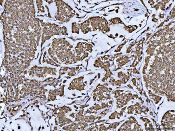 PPP4C Antibody