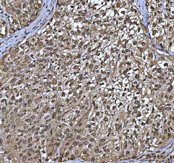 PPP4C Antibody