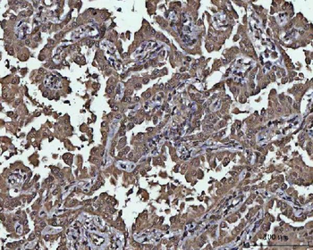 PPP4C Antibody