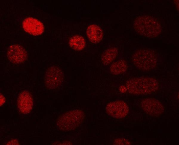 PPP3CA Antibody