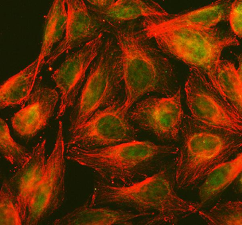 PPP2R5D Rabbit Polyclonal Antibody