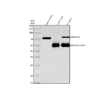 PPP2R5D Rabbit Polyclonal Antibody