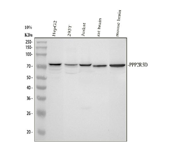 PPP2R5D Rabbit Polyclonal Antibody