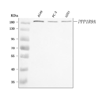 PPP1R9A Rabbit Polyclonal Antibody