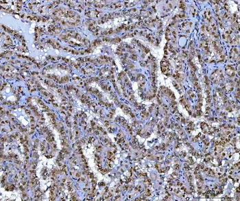 BCL11B Antibody