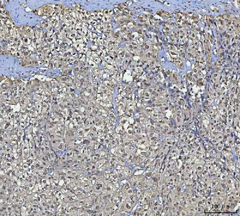 BCL11B Antibody