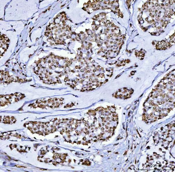 BCL11B Antibody