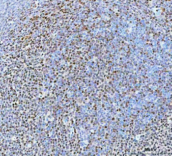 BCL11B Antibody