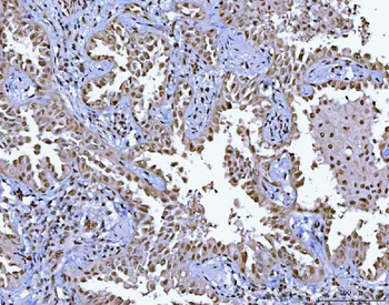 BCL11B Antibody