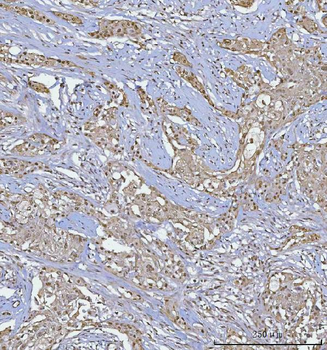 BCL11B Antibody