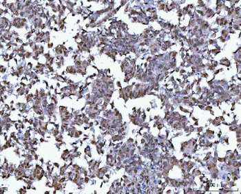 BCL11B Antibody