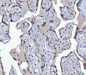 BCL11B Antibody