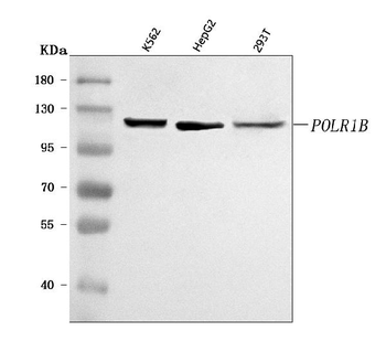 POLR1B Rabbit Polyclonal Antibody