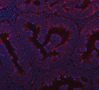 PRDM15 Antibody