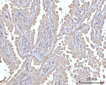 PRDM15 Antibody