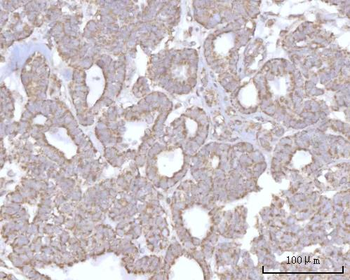 PRDM15 Antibody