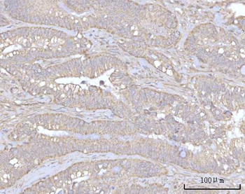 PRDM15 Antibody