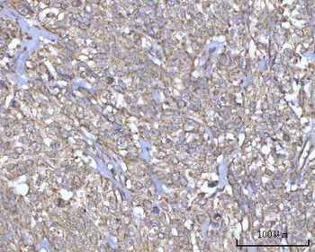 PRDM15 Antibody